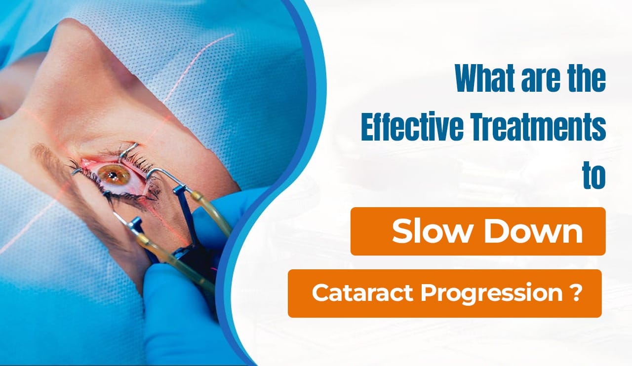 What are the Effective Treatments to Slow Down Cataract Progression?