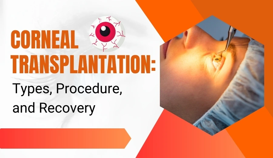 What is Corneal Transplantation? Types, Procedure and Recovery