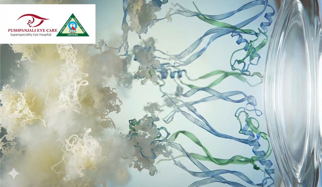 The Story of Protein Unfolding: What Exactly is Happening to Your Eye?