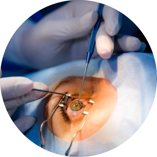 Best Cornea Specialist