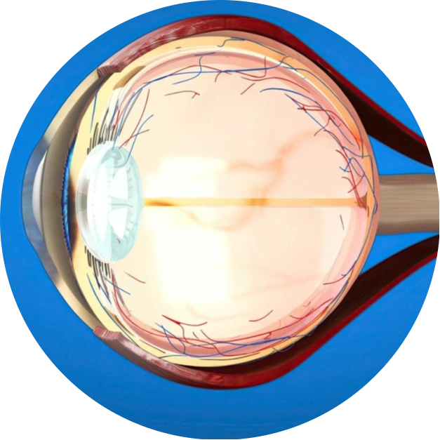 Retina Specialist In Kolkata