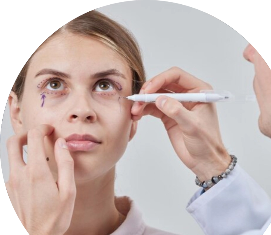 Oculoplasty Specialist